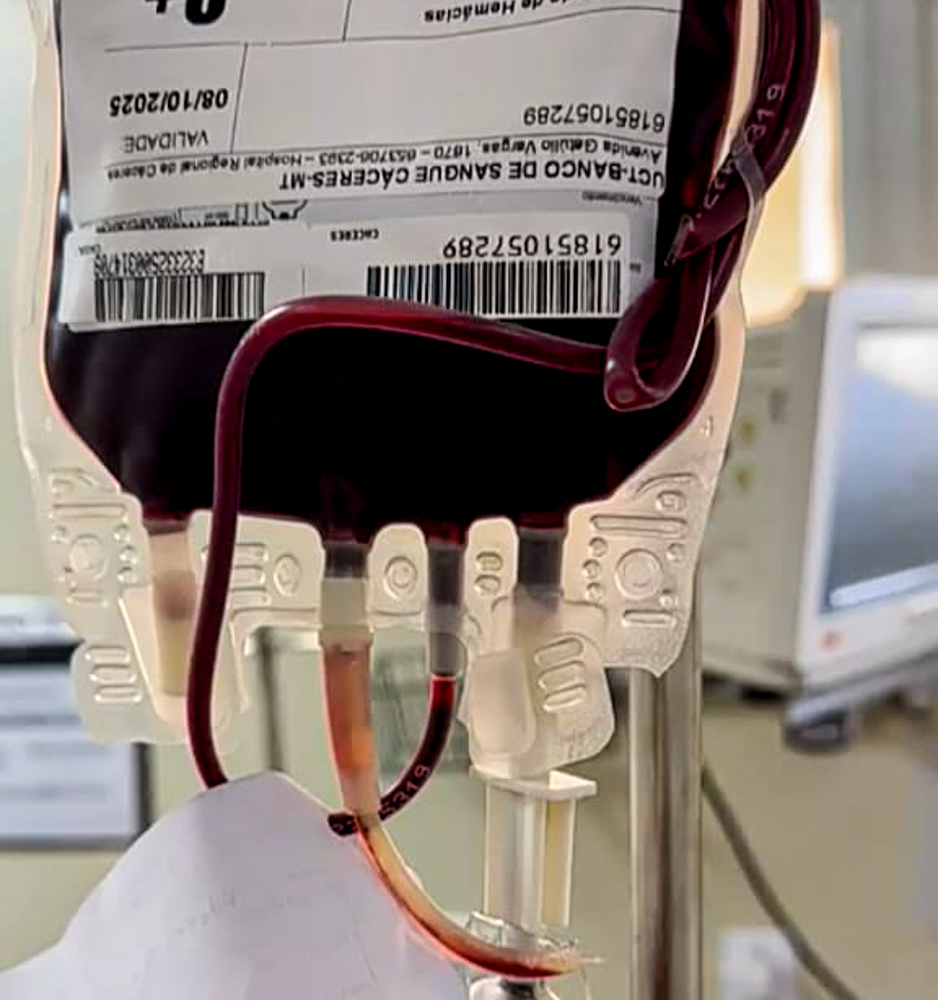 UPA de Cáceres realiza primeira transfusão de urgência em parceria com o Hospital Regional